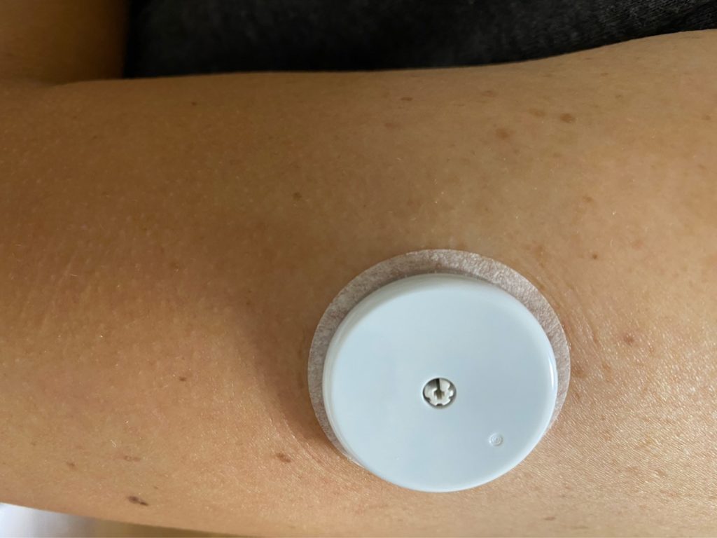 FreeStyleリブレ取り付け後